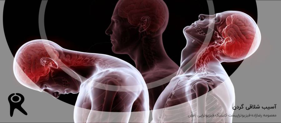 آسیب شلاقی گردن | علل، علائم، تشخیص و فیزیوتراپی و تمرینات ورزشی
