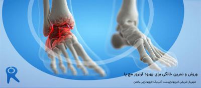 7 ورزش و تمرین خانگی برای بهبود آرتروز مچ پا