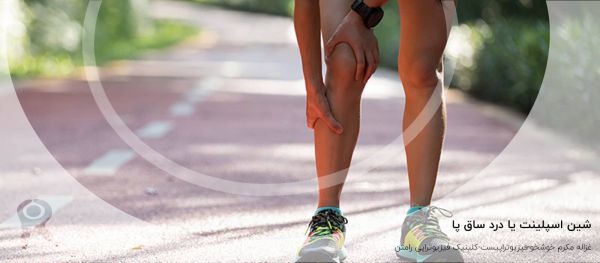 شین اسپلینت (درد ساق پا) | علل، علائم، تشخیص، پیشگیری و درمانها